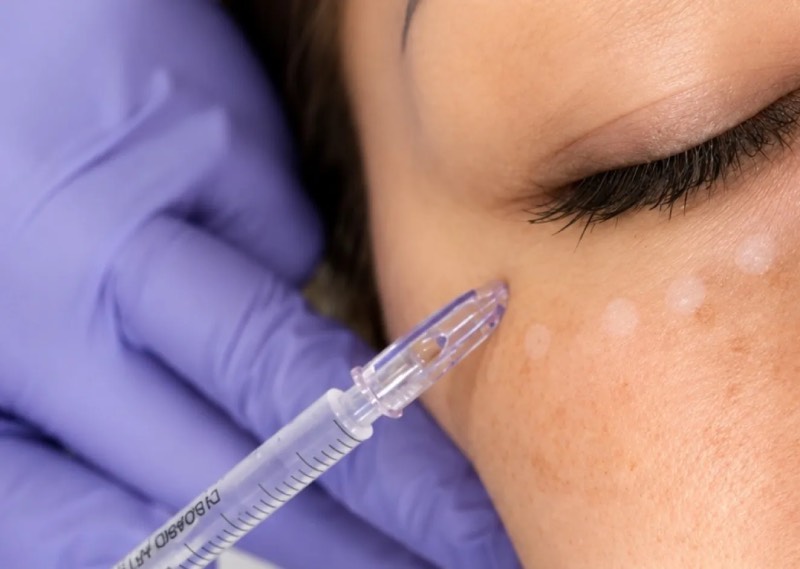 Certificación de Microneedling Regenerativo