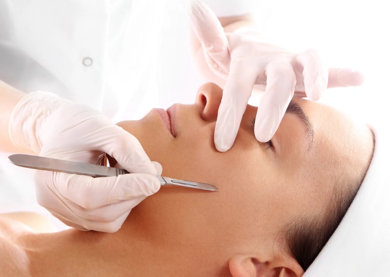 dermaplaning