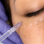 CERTIFICACIÓN EN MICRONEEDLING REGENERATIVO
